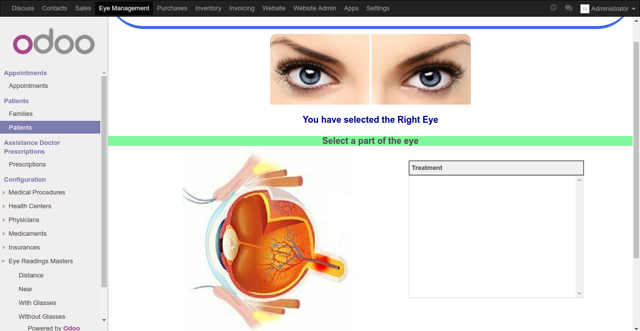 Screenshot of odoo eye clinic managment software